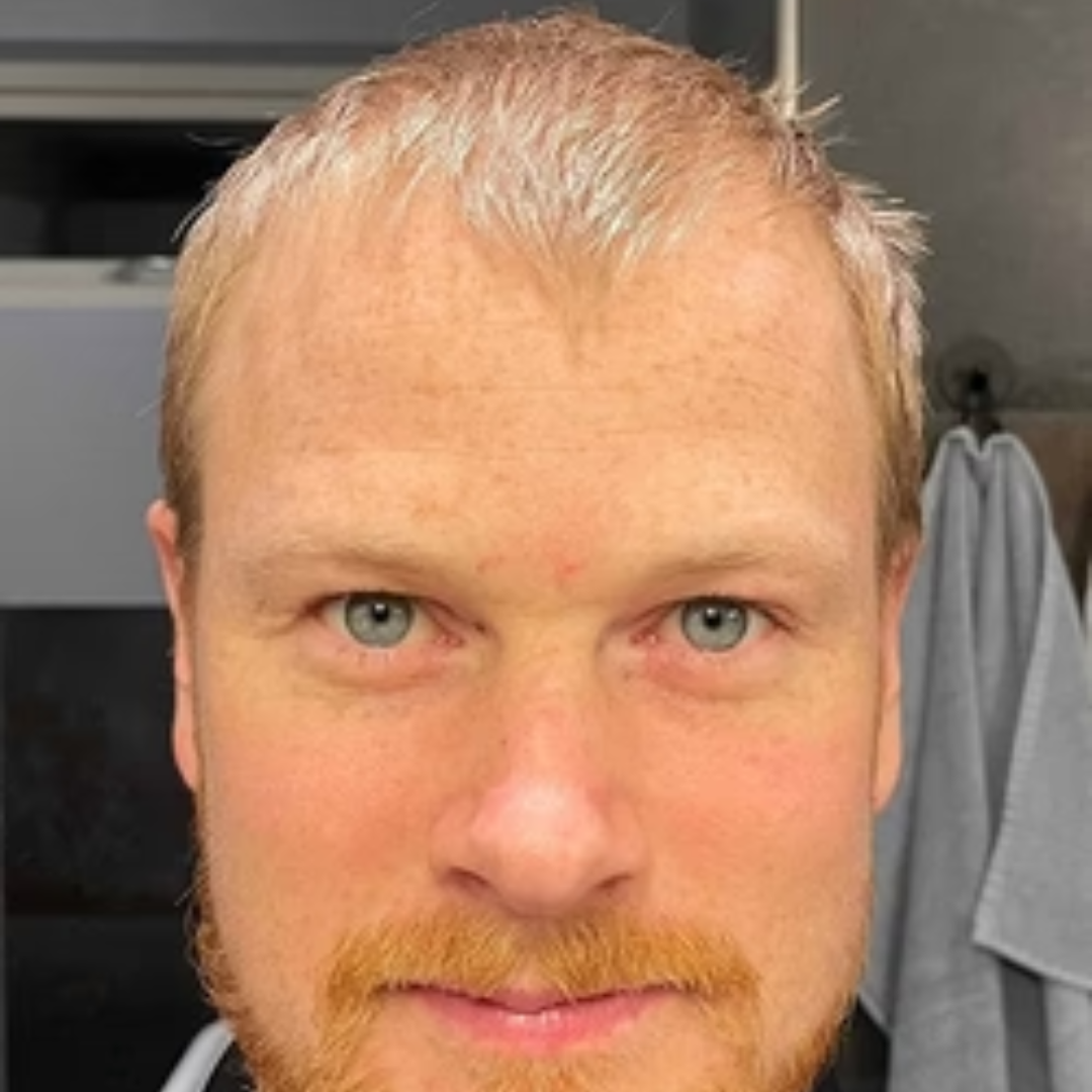 Marc Roland Liege Top 3 Solutions Anti-Chute Cheveux Homme 2025 – Les Chroniques de Bella